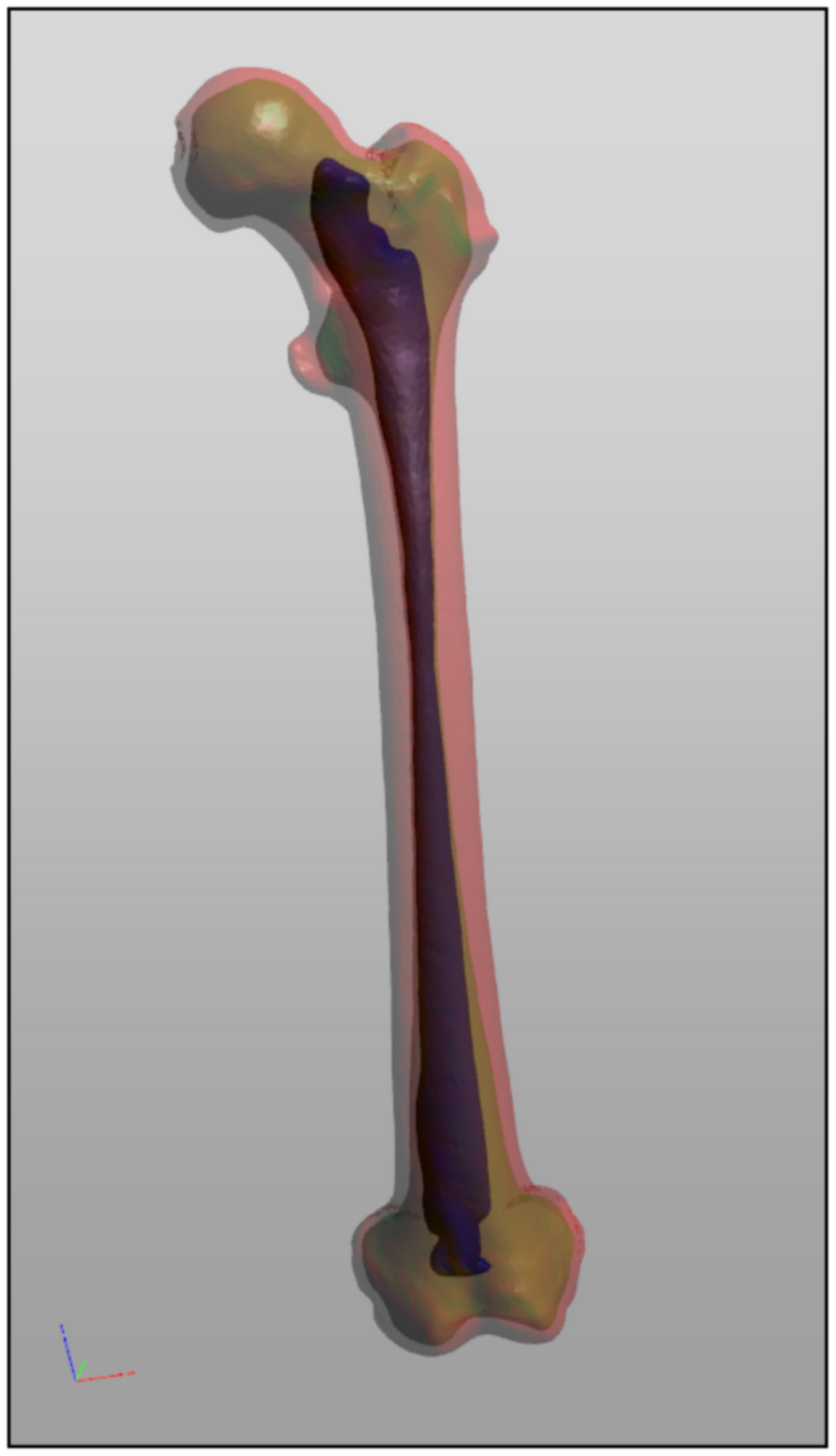 A 3D reconstruction of a human femur built by stacking the contours segmented from a series of cross-sectional medical scans